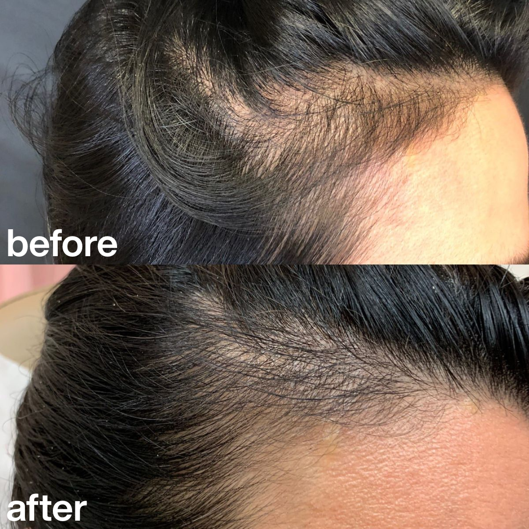 "This scrub is the only thing that helped with the irritation on my scalp." Amelia T