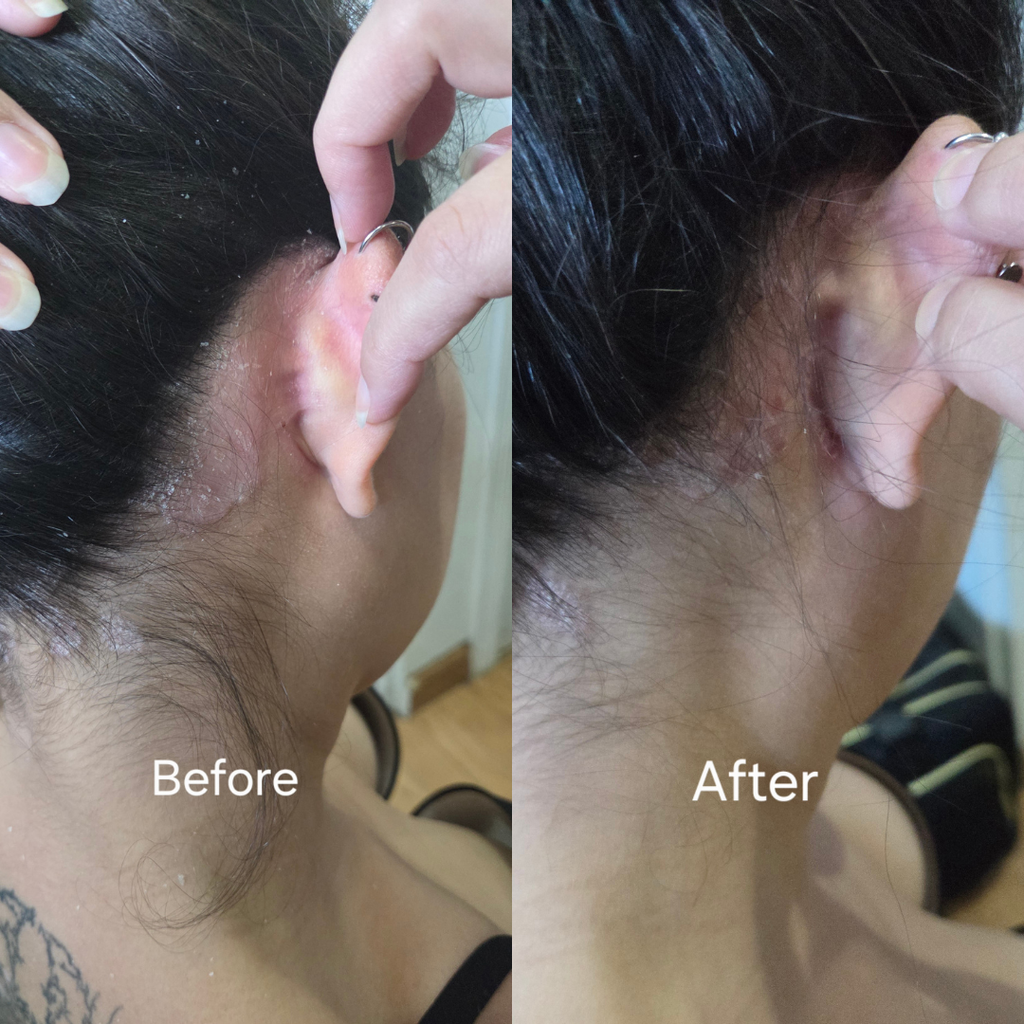 "This scrub is the only thing that helped with the irritation on my scalp." Amelia T