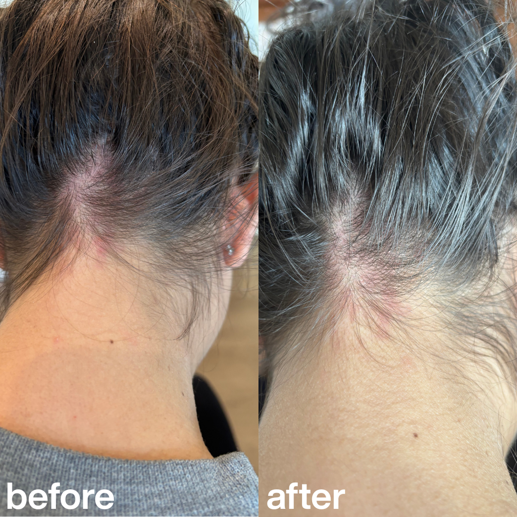 "This scrub is the only thing that helped with the irritation on my scalp." Amelia T