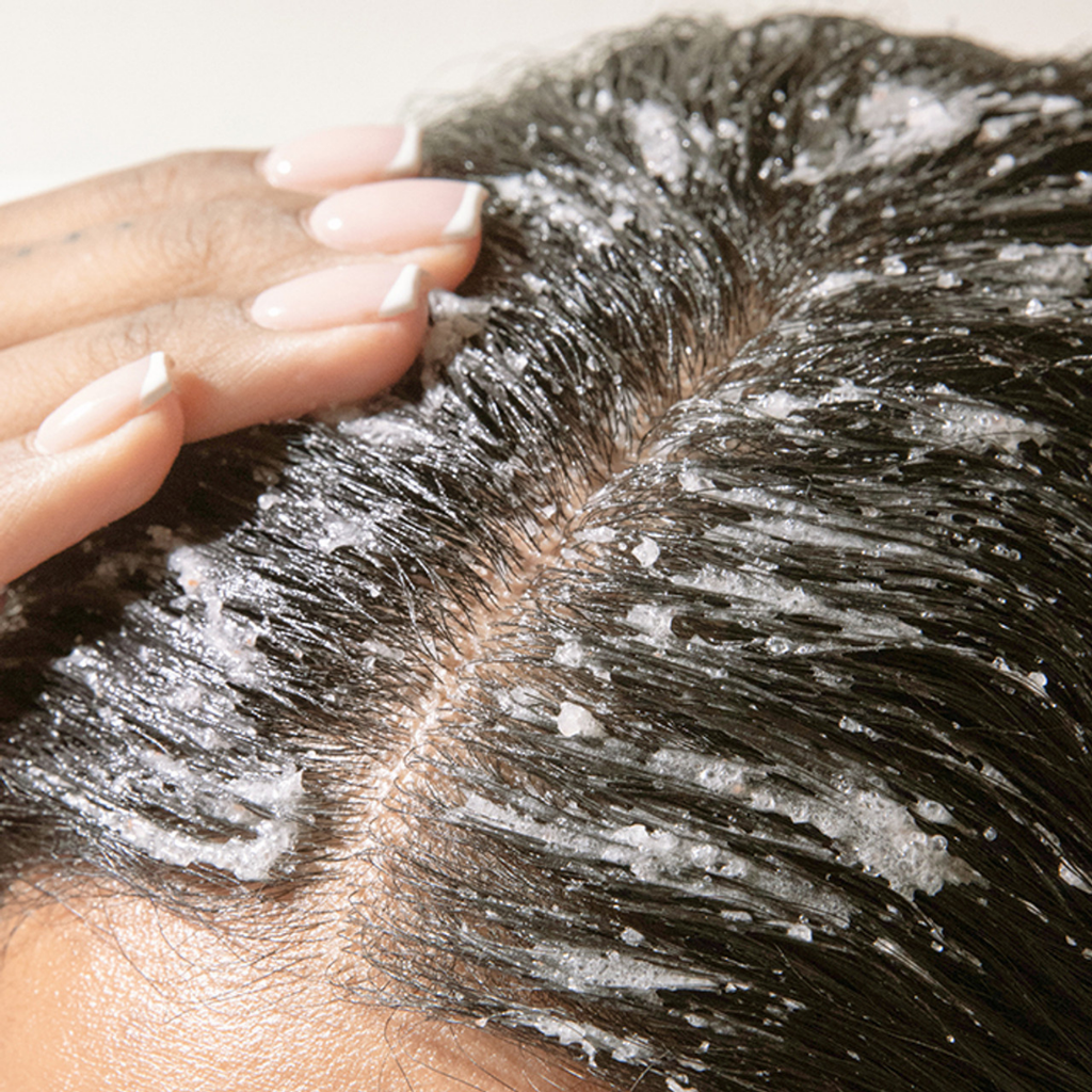 "This scrub is the only thing that helped with the irritation on my scalp." Amelia T