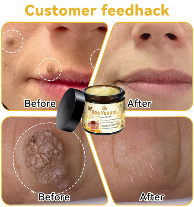 😍 Buy 1, Get 2 FREE 🎁 ✨ Bee Venom Treatment Cream