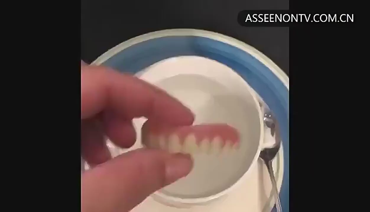 Premium Full Denture Set – Restore Your Confident Smile at Home
